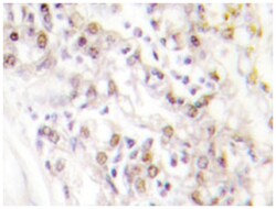 KIF20A Rabbit anti-Human, Polyclonal Antibody, Abnova 100 &mu;L | Buy Online | Abnova | Fisher Scientific
