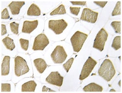 CYP7B1, Rabbit, Polyclonal Antibody, Abnova 100 &mu;L | Buy Online | Abnova Corporation | Fisher Scientific