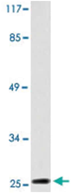 CLDN6, Rabbit, Polyclonal Antibody, Abnova 100&mu;L; Unlabeled:Antibodies,