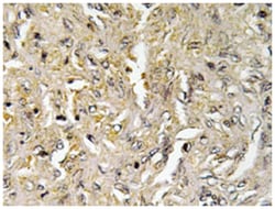 CLDN6, Rabbit, Polyclonal Antibody, Abnova 100&mu;L; Unlabeled:Antibodies,