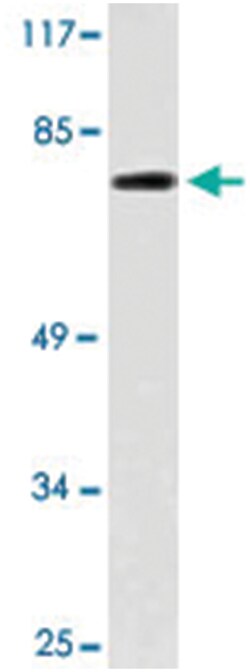 GNPAT, Rabbit, Polyclonal Antibody, Abnova 100 &mu;L | Buy Online | Abnova Corporation | Fisher Scientific