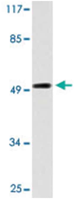 EFEMP2, Rabbit, Polyclonal Antibody, Abnova 100 &mu;L | Buy Online | Abnova Corporation | Fisher Scientific