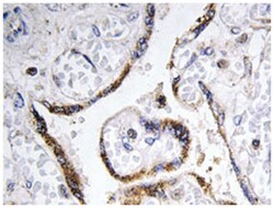 EFEMP2, Rabbit, Polyclonal Antibody, Abnova 100 &mu;L | Buy Online | Abnova Corporation | Fisher Scientific