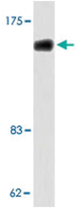 ABCC10, Rabbit, Polyclonal Antibody, Abnova 100&mu;L; Unlabeled:Antibodies,