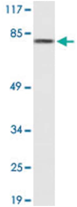 CTTN Rabbit anti-Human, Polyclonal Antibody, Abnova 100&mu;L; Unlabeled:Antibodies,