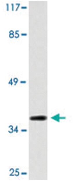 AVPR2 Rabbit anti-Human, Polyclonal Antibody, Abnova 100 &mu;L | Buy Online | Abnova Corporation | Fisher Scientific