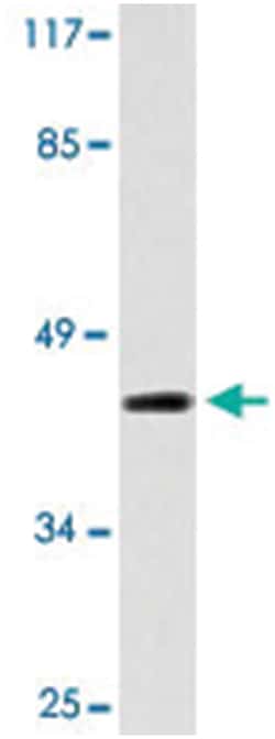 OXER1 Rabbit anti-Human, Polyclonal Antibody, Abnova 100 &mu;L | Buy Online | Abnova Corporation | Fisher Scientific