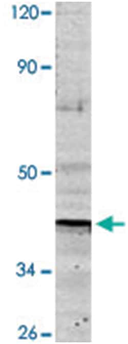 ND1, Rabbit, Polyclonal Antibody, Abnova 100&mu;L; Unlabeled:Antibodies,