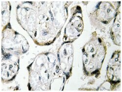 ND1, Rabbit, Polyclonal Antibody, Abnova 100&mu;L; Unlabeled:Antibodies,