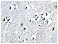 N4BP1 Rabbit anti-Human, Polyclonal Antibody, Abnova 100&mu;L; Unlabeled:Antibodies,