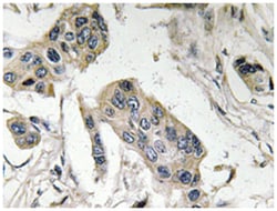 FUT4, Rabbit, Polyclonal Antibody, Abnova 100 &mu;L | Buy Online | Abnova Corporation | Fisher Scientific