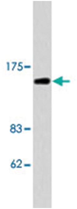 LEPR Rabbit anti-Human, Polyclonal Antibody, Abnova 100 &mu;L | Buy Online | Abnova | Fisher Scientific