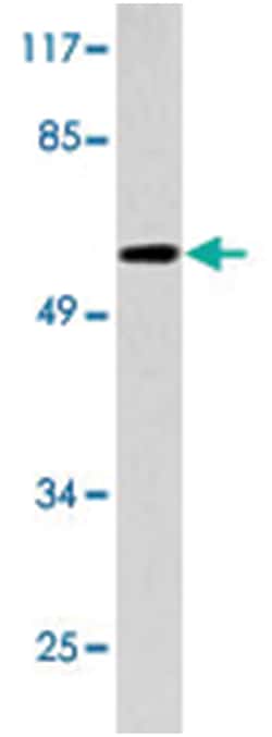 IL20RA Rabbit anti-Human, Polyclonal Antibody, Abnova 100 &mu;L | Buy Online | Abnova Corporation | Fisher Scientific