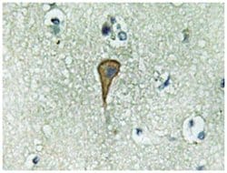 IL20RA Rabbit anti-Human, Polyclonal Antibody, Abnova 100 &mu;L | Buy Online | Abnova Corporation | Fisher Scientific