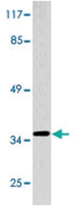AQP5 Rabbit anti-Human, Polyclonal Antibody, Abnova 100&mu;L; Unlabeled:Antibodies,