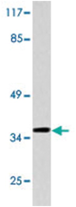 PAX1, Rabbit, Polyclonal Antibody, Abnova 100 &mu;L | Buy Online | Abnova Corporation | Fisher Scientific