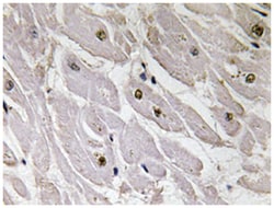 PAX1, Rabbit, Polyclonal Antibody, Abnova 100 &mu;L | Buy Online | Abnova Corporation | Fisher Scientific