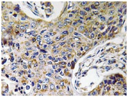 ATP5J2, Rabbit, Polyclonal Antibody, Abnova 100&mu;L; Unlabeled:Antibodies,