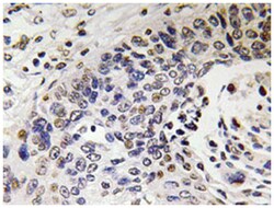 NEFH Rabbit anti-Human, Polyclonal Antibody, Abnova 100&mu;L; Unlabeled:Antibodies,