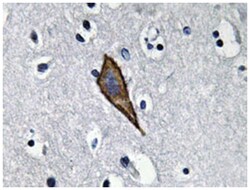 ANPEP, Rabbit, Polyclonal Antibody, Abnova 100μL; Unlabeled:Antibodies,