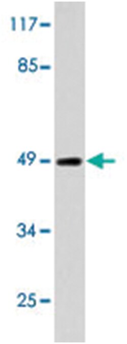 CASP12, Rabbit, Polyclonal Antibody, Abnova 100 &mu;L | Buy Online | Abnova Corporation | Fisher Scientific