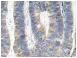 EIF2AK2 Rabbit anti-Human, Polyclonal Antibody, Abnova 100&mu;L; Unlabeled:Antibodies,