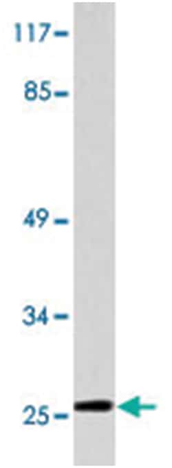IL32 Rabbit anti-Human, Polyclonal Antibody, Abnova 100 &mu;L | Buy Online | Abnova Corporation | Fisher Scientific