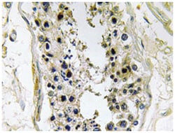BMP8B, Rabbit, Polyclonal Antibody, Abnova 100&mu;L; Unlabeled:Antibodies,