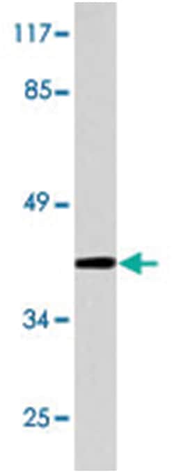 Pepsin A, Rabbit, Polyclonal Antibody, Abnova 100 &mu;L | Buy Online | Abnova Corporation | Fisher Scientific