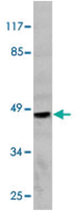 MMP12 Rabbit anti-Human, Polyclonal Antibody, Abnova 100&mu;L; Unlabeled:Antibodies,