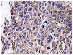 MMP12 Rabbit anti-Human, Polyclonal Antibody, Abnova 100&mu;L; Unlabeled:Antibodies,