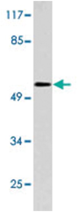 CD3EAP, Rabbit, Polyclonal Antibody, Abnova 100 &mu;L | Buy Online | Abnova | Fisher Scientific