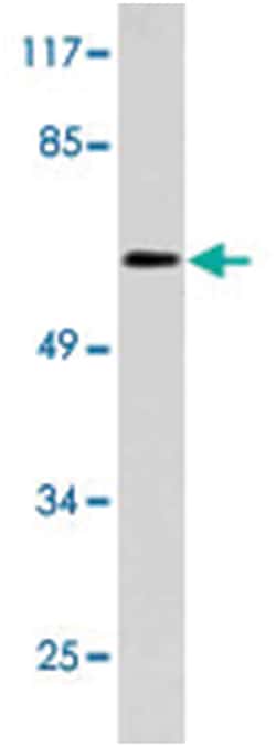 ENTPD1, Rabbit, Polyclonal Antibody, Abnova 100&mu;L; Unlabeled:Antibodies,