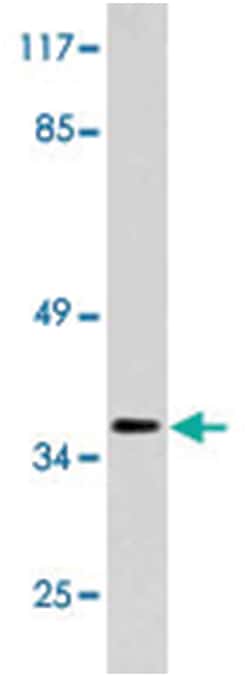 GDF15 Rabbit anti-Human, Polyclonal Antibody, Abnova 100 &mu;L | Buy Online | Abnova Corporation | Fisher Scientific