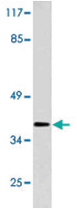 HOXB2 Rabbit anti-Human, Polyclonal Antibody, Abnova 100 &mu;L | Buy Online | Abnova Corporation | Fisher Scientific