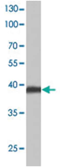 NCR1, Rabbit, Polyclonal Antibody, Abnova 100 &mu;L | Buy Online | Abnova | Fisher Scientific