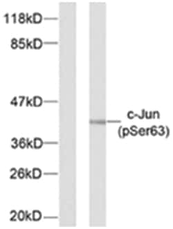 JUN (phospho S63), Rabbit anti-Human, Mouse, Rat, Polyclonal Antibody,