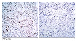 JUN (phospho S63), Rabbit anti-Human, Mouse, Rat, Polyclonal Antibody,