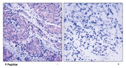 PDPK1 (phospho S241), Rabbit anti-Human, Mouse, Rat, Polyclonal Antibody, Abnova 100 &mu;g | Buy Online | Abnova | Fisher Scientific