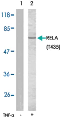 RELA (phospho T435), Rabbit anti-Human, Mouse, Rat, Polyclonal Antibody,