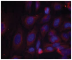 NFKB1 (phospho S893), Rabbit anti-Human, Polyclonal Antibody, Abnova 100 &mu;g | Buy Online | Abnova Corporation | Fisher Scientific