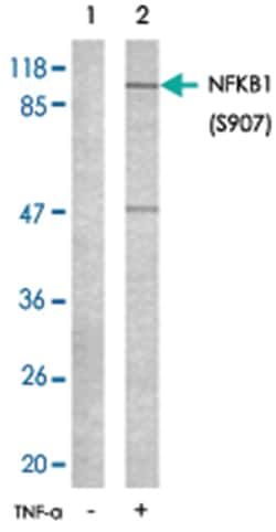 NFKB1 (phospho S907), Rabbit anti-Human, Polyclonal Antibody, Abnova 100&mu;g;