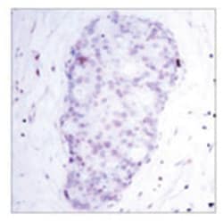 NFKB1 (phospho S907), Rabbit anti-Human, Polyclonal Antibody, Abnova 100&mu;g;
