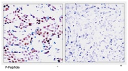 JUN (phospho T91), Rabbit anti-Human, Mouse, Rat, Polyclonal Antibody,