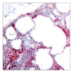 ATF2 (phospho S44/S62), Rabbit anti-Human, Mouse, Rat, Polyclonal Antibody, Abnova 100 &mu;g | Buy Online | Abnova Corporation | Fisher Scientific