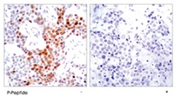 ATF2 (phospho T51/T69), Rabbit anti-Human, Mouse, Rat, Polyclonal Antibody, Abnova 100 &mu;g | Buy Online | Abnova Corporation | Fisher Scientific