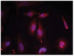ATF2 (phospho T51/T69), Rabbit anti-Human, Mouse, Rat, Polyclonal Antibody, Abnova 100 &mu;g | Buy Online | Abnova Corporation | Fisher Scientific