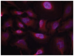 ATF2 (phospho T55/T73), Rabbit anti-Human, Mouse, Rat, Polyclonal Antibody,
