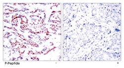 ATF2 (phospho S94/S112), Rabbit anti-Human, Mouse, Rat, Polyclonal Antibody, Abnova 100 &mu;g | Buy Online | Abnova Corporation | Fisher Scientific