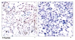 MYC (phospho T358), Rabbit anti-Human, Mouse, Rat, Polyclonal Antibody, Abnova 100 &mu;g | Buy Online | Abnova Corporation | Fisher Scientific